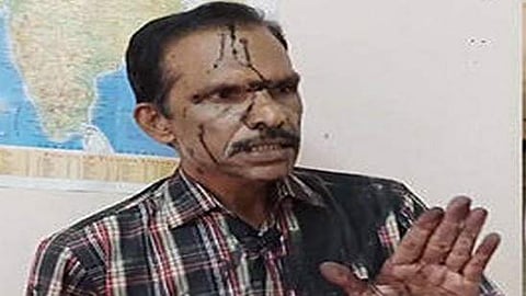 'നിയമം കയ്യിലെടുക്കാന് സ്ത്രീക്കും പുരുഷനും അധികാരമില്ല'; വിജയ് പി നായരെ മര്ദിച്ചവര്ക്ക് എതിരെ നടപടി വേണം; മനുഷ്യാവകാശ കമ്മീഷന്