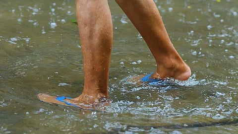 Leptospirosis cases seen surging in next 2 weeks
