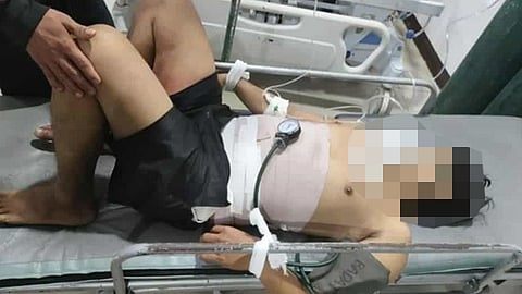 Nagmaoy nga pag-umangkon
gidunggab sa uyoan, kritikal