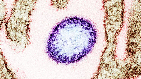 DOH: Way travel restrictions gipatuman tungod sa Nipah