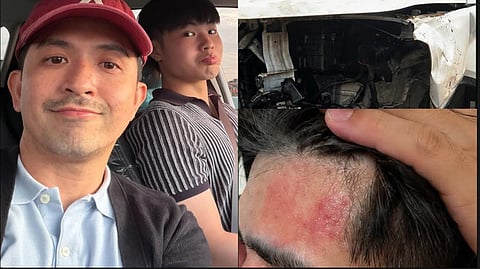 Dennis Trillo’s son Calix survives car accident