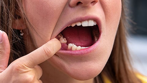 Lost a tooth? Science may one day grow it back
