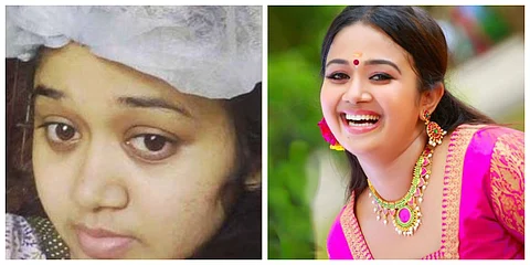 ട്യൂമറിനെ തോല്പ്പിക്കാന് ശരണ്യ; 7 വര്ഷത്തിനിടെ 7 ശസ്ത്രക്രിയകള്; ‘ഒരു കൈ സഹായം വേണം’