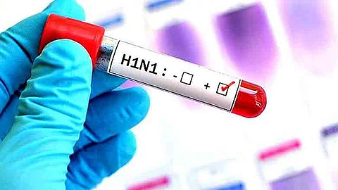 എച്ച് വണ് എന് വണ്: ജാഗ്രത വേണം; ഈമാസം ചികിത്സ തേടിയത് 146 പേര്; 10 മരണം