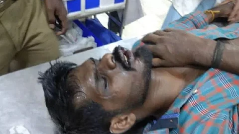 വാളയാര് കേസ് പ്രതിക്ക് ആള്ക്കൂട്ട മര്ദ്ദനം; മധു ആശുപത്രിയില്