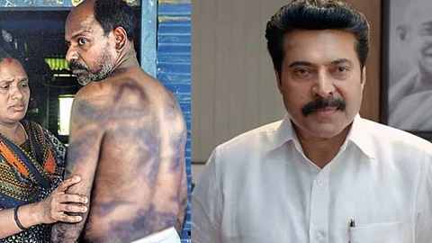 ‘തൊഴിലുടമയുടെ ക്രൂരപീഡനം’; ഹരിദാസിന് സഹായവുമായി മമ്മൂട്ടി ഡയറക്ടറായ ചികിത്സാകേന്ദ്രം