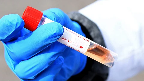 24 മണിക്കൂറില് 5242 പുതിയ കേസുകള്, മരണം 157; രാജ്യത്ത് കൊവിഡ് ബാധിതരുടെ എണ്ണം 96,000 കടന്നു