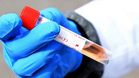 24 മണിക്കൂറില് 3967 പുതിയ രോഗികള്; രാജ്യത്ത് കൊവിഡ് ബാധിതരുടെ എണ്ണം 80,000 കടന്നു