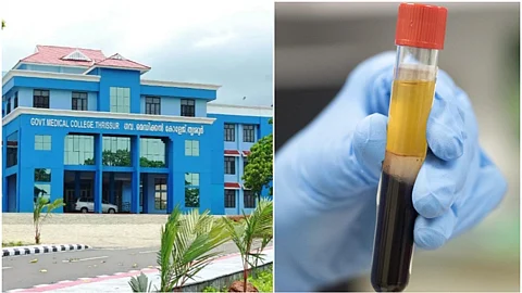 കോവിഡിന് പ്ലാസ്മ തെറാപ്പി; തൃശൂര് മെഡിക്കല് കോളേജിലെ രോഗി സുഖം പ്രാപിക്കുന്നുവെന്ന് അധികൃതര്