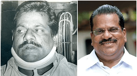 രാത്രി ഉറങ്ങാന് പറ്റില്ലായിരുന്നു, ഇപ്പോഴും കാലില് നീരുണ്ടാകും; വെടിയേറ്റതിന്റെ അസ്വസ്ഥതകള് ഇപ്പോഴുമുണ്ടെന്ന് ഇ.പി ജയരാജന്