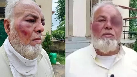 'ജയ്ശ്രീറാമും മോദി സിന്ദാബാദും വിളിച്ചില്ല', രാജസ്ഥാനില് ഓട്ടോഡ്രൈവര്ക്ക് ക്രൂരമര്ദ്ദനം, പാക്കിസ്ഥാനിലേക്ക് പോകാനും ആക്രോശം