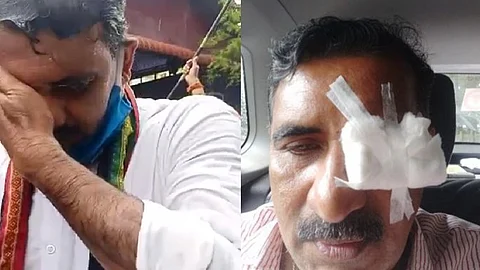 ജലീലിന്റെ രാജി ആവശ്യപ്പെട്ട് നടന്ന പ്രതിഷേധത്തിനിടെ സംഘര്ഷം: ബി. ഗോപാലകൃഷ്ണന് പരിക്ക്