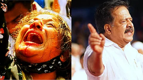 ഇത് കമ്യൂണിസ്റ്റ് ഏകാധിപത്യ രാജ്യമല്ല; പിണറായി പോലീസ് നരനായാട്ട് നടത്തുന്നുവെന്ന് ചെന്നിത്തല