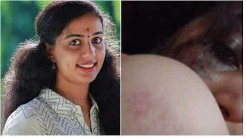 മകളെ ഉപദ്രവിച്ചത് സ്ത്രീധനം നൽകിയ വണ്ടി ഇഷ്ട്ടപ്പെടാത്തത് കൊണ്ടെന്ന് യുവതിയുടെ അച്ഛൻ; ക്രൂരതകൾ വെളിവാക്കുന്ന ചാറ്റുകൾ പുറത്ത്