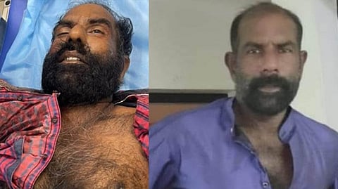 സി.പി.എം പ്രവര്ത്തകനെ വെട്ടിക്കൊന്നു; കാല് അറുത്തുമാറ്റി