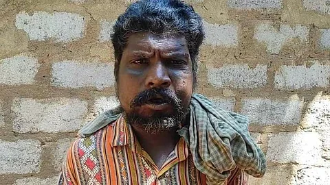 100 രൂപ അധികം ചോദിച്ചതിന് ആദിവാസി തൊഴിലാളിക്ക് ക്രൂര മർദ്ദനം, താടിയെല്ല് ചവിട്ടിയൊടിച്ചു