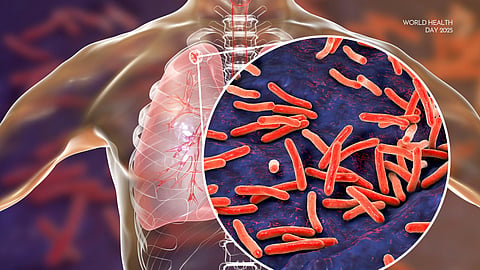 Why can’t we defeat the oldest disease known to humankind?