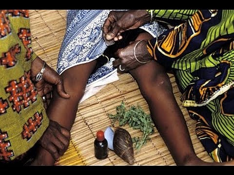 Female Genital Mutilation or the practice of Khatna/khafd : If triple talaq can be addressed by the Government, why the blind eye to FGM?