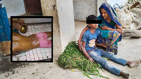 उत्तर प्रदेश: नशे में धुत शिक्षक पर दलित छात्र की बर्बरता से पिटाई का आरोप