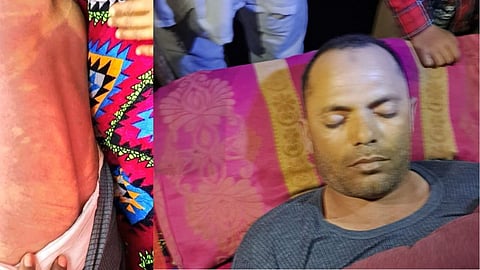 पीठ पर चोट के निशान और मृतक मुस्लिम कारोबारी।