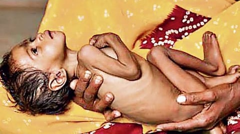 सांकेतिक फोटो