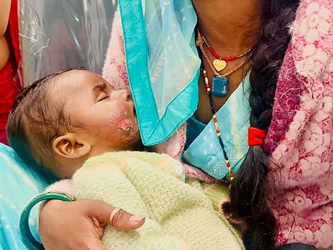 MP: अंधविश्वास की आग में झुलसा 6 महीने का मासूम: तांत्रिक की झाड़फूंक से दोनों आंखों की कॉर्निया जलकर सफेद पड़ीं