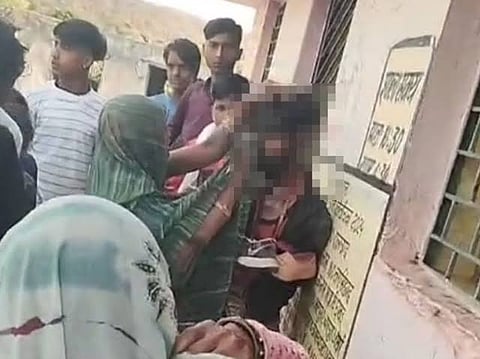 राजगढ़ में दलित युवकों का मुंह काला कर गाँव मे घुमाया