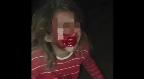 सोशल मीडिया पर बहुजन समुदाय में इस मामले को लेकर काफी आक्रोश है, जहां लोग कठोर कार्रवाई और न्याय की मांग कर रहे हैं।