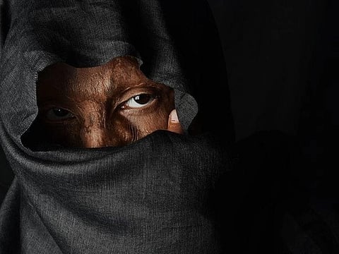 Representational image of an acid-attack victim