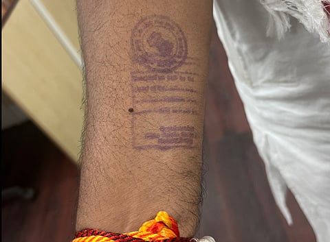 On his X handle, Soren shared a poignant image of his arm, bearing the stamp he received upon his release from jail.