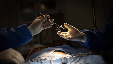 Representative image of surgical scissors