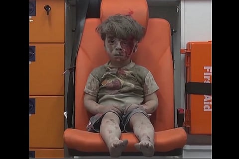 Omran, Syrian boy whose shell-shocked image went viral, loses brother to injuries from airstrike
