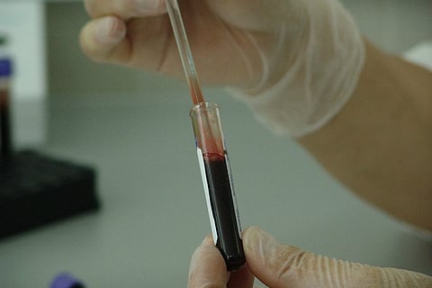 Explainer: the A, B, C, D and E of hepatitis
