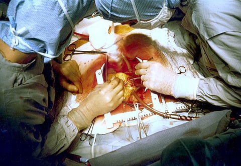 The definitive cure for an ailing human heart is another one