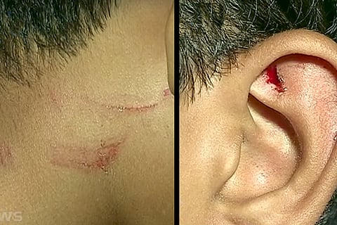 'My son's ears were bleeding': Kerala mother recounts harrowing assault on 14-yr-old