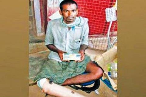 He lost a leg and took to begging, now won a lottery worth Rs 65 lakh