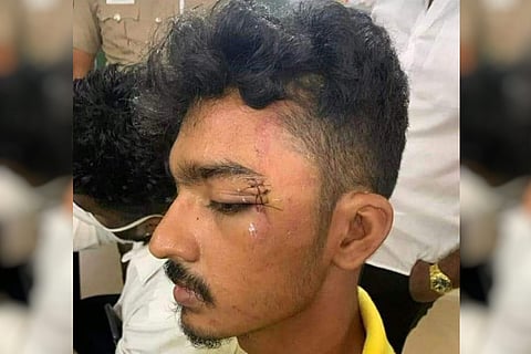Man with an injured eyelid: Two Chennai cops face action after student’s complaint
