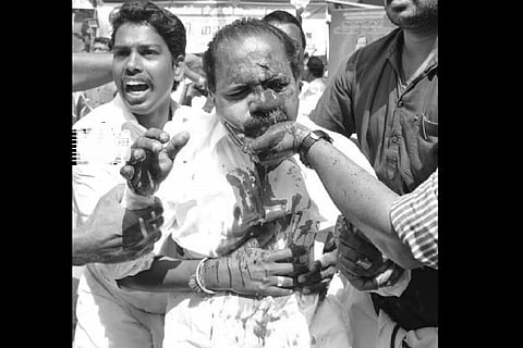 Law Academy clashes: Kerala BJP leader Vava loses vision in police action