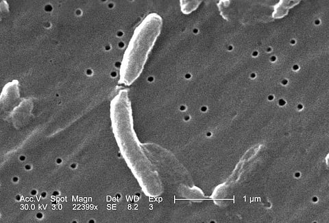Cholera outbreak in Kerala, health officials advise caution