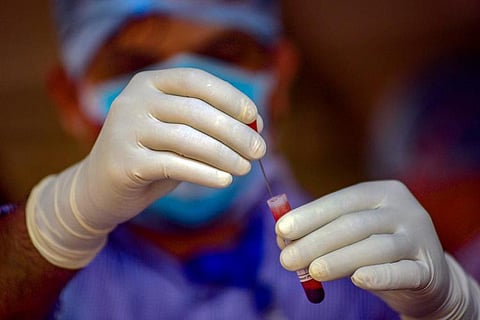 Karnataka’s first COVID-19 patient to undergo plasma therapy dies