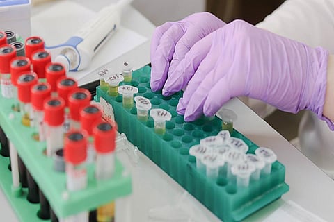 Coronavirus test samples