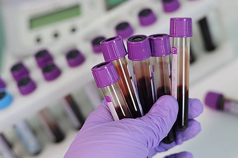 Centre allows pvt labs to test for coronavirus, places price cap of Rs 4,500 per test