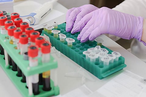 COVID-19: Breakdown of samples collected across India till March 18