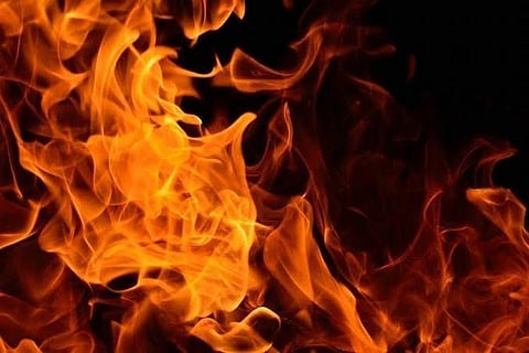 Chennai woman who set herself on fire in a Hyd police station succumbs to injuries