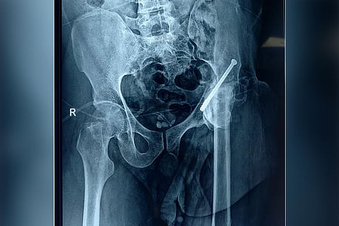 An X-ray of Kasim
