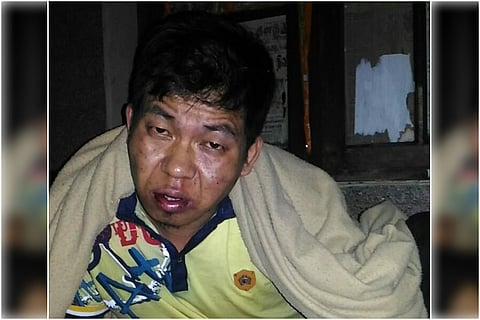Manipuri man assaulted in Bengaluru allegedly by staff of restaurant he worked in