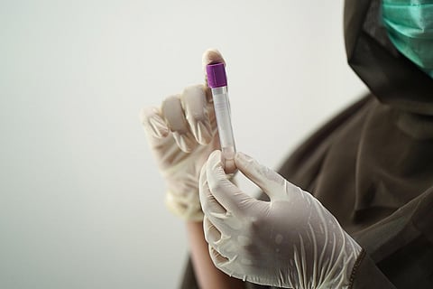 Image of a test sample