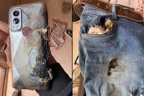 OnePlus phone allegedly explodes in pocket
