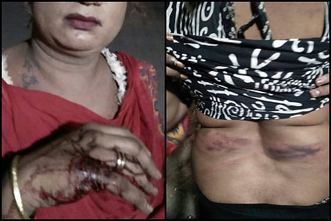 Transgender woman allegedly thrashed by army men in Secunderabad, cops say they're helpless