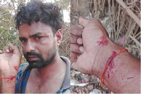 Reporter beaten up in Telangana for posting pictures of illegal sand excavation
